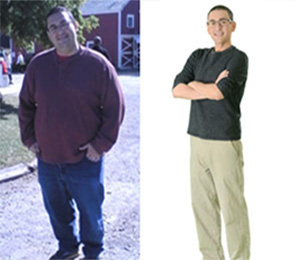 gastric bypass surgery patient Vince